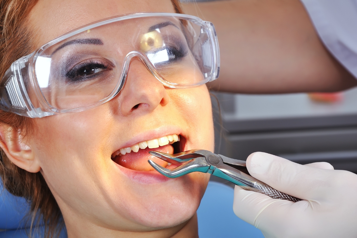 tooth extractions in Chicago Heights
